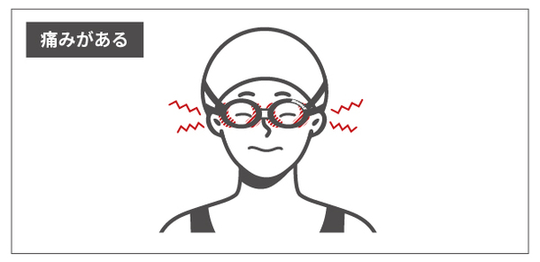 痛みの原因（締めすぎ・鼻ベルト短すぎ）の例