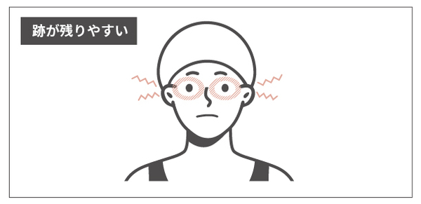 ゴーグルの跡が残る原因（圧迫過多）の例